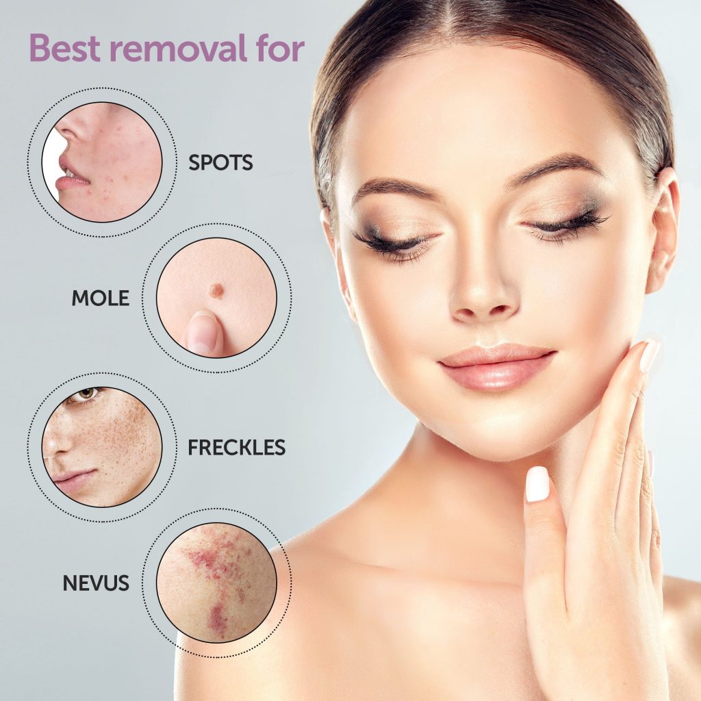 skin_tag_removal_products